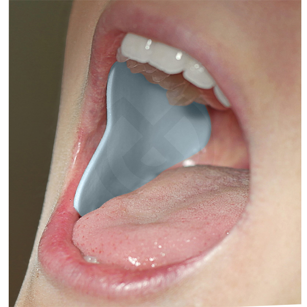 DryDent® parotid, liten – DIRECTA