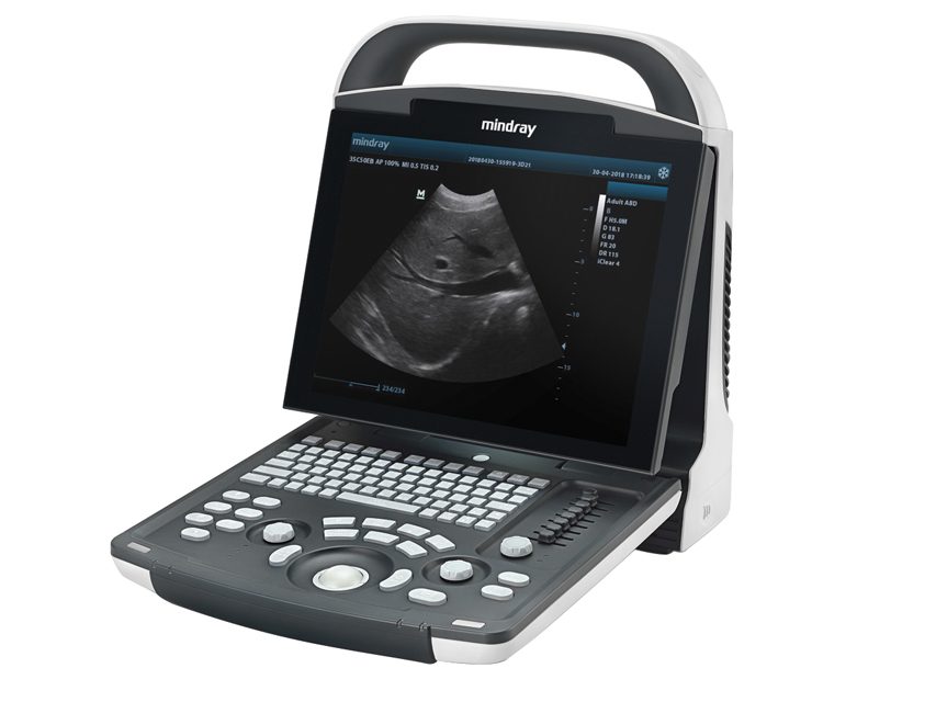 Mindray DP-20 - przenośny aparat ultrasonograficzny