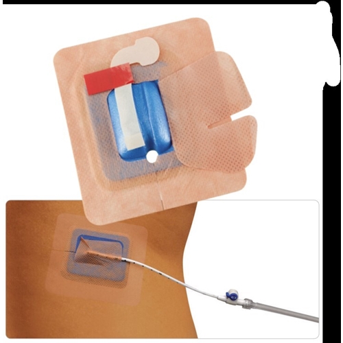 Fikseringsbandage til drænage StayFix - 15-24Fr Large 10x9cm - 20 stk