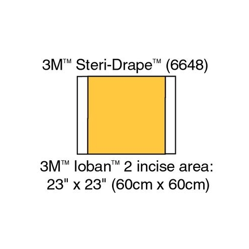 Antimikrobielles Inzisionstuch mit Kleberand - 56x60cm (66x60cm) - 10 St.