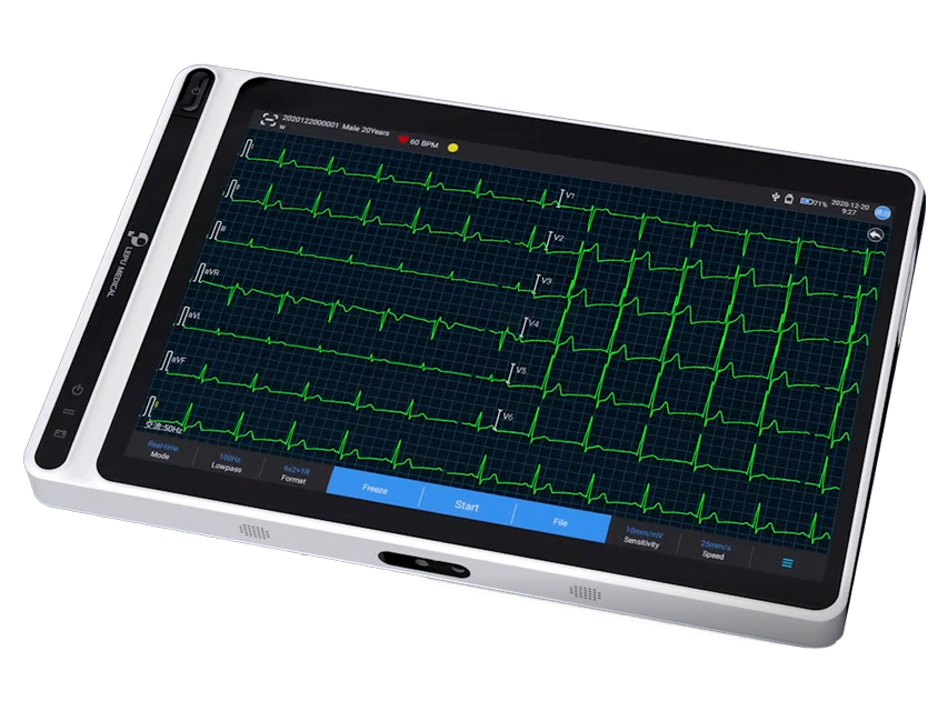 Neo ECG S120 Tablet ECG – Snap Plug