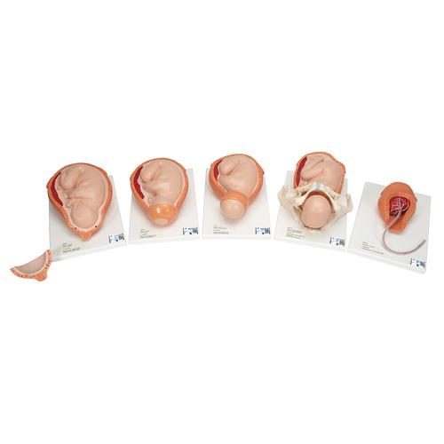 5-stufiges Modell des Geburtsprozesses