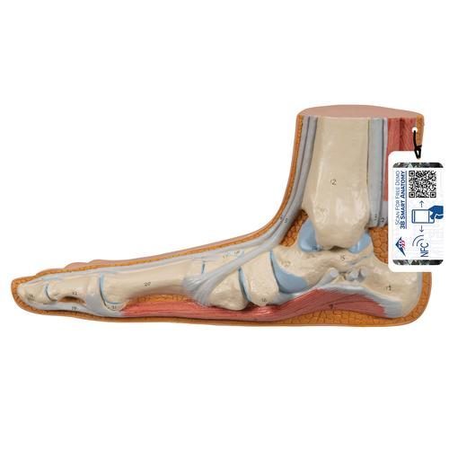 Platt fot (Pes Planus) modell