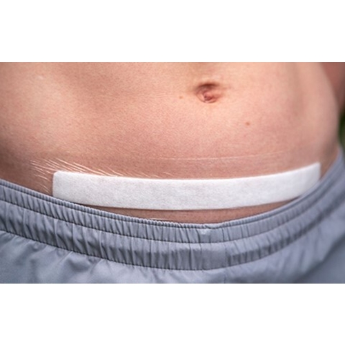 Superabsorberende bandage Erland Care - 5x25 cm silikone Border - 10 stk.