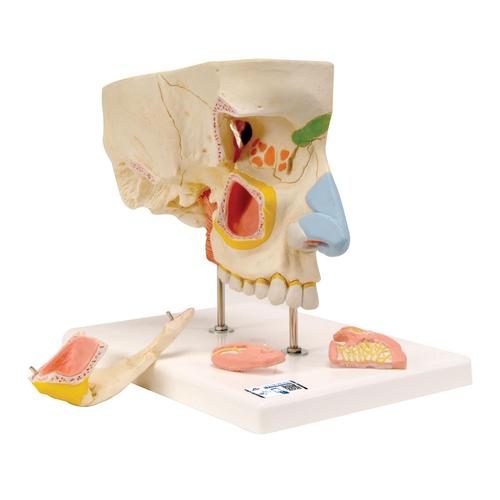 Anatomisches Nasenmodell mit Nasennebenhöhlen 5-teilig