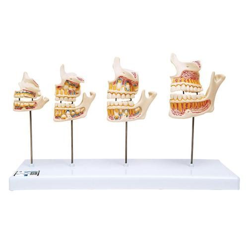 Dentition Utvecklingsmodell