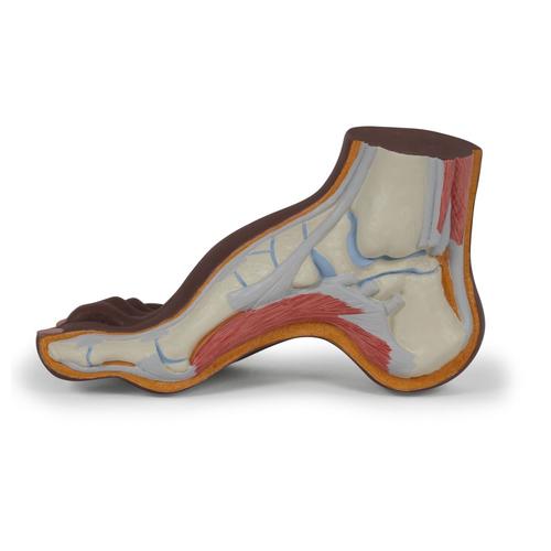 Hålfotsmodell (Pes Cavus), mörk hud