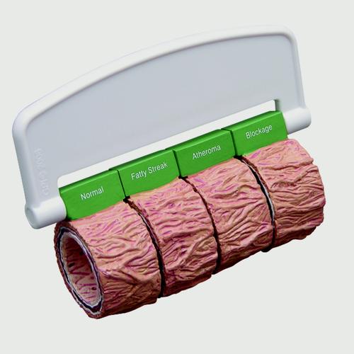 Arterienschnitt (4) groß - mit Griff