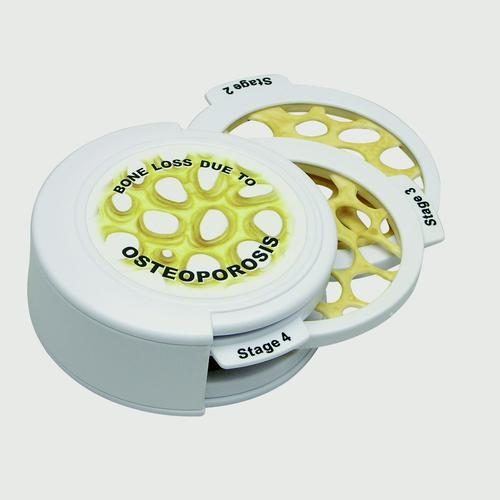 Gwintowany zestaw dysków - 4 szt. Osteoporos