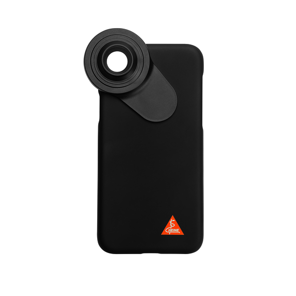 Heine adapter til smartphone Delta 30/one/11 Pro
