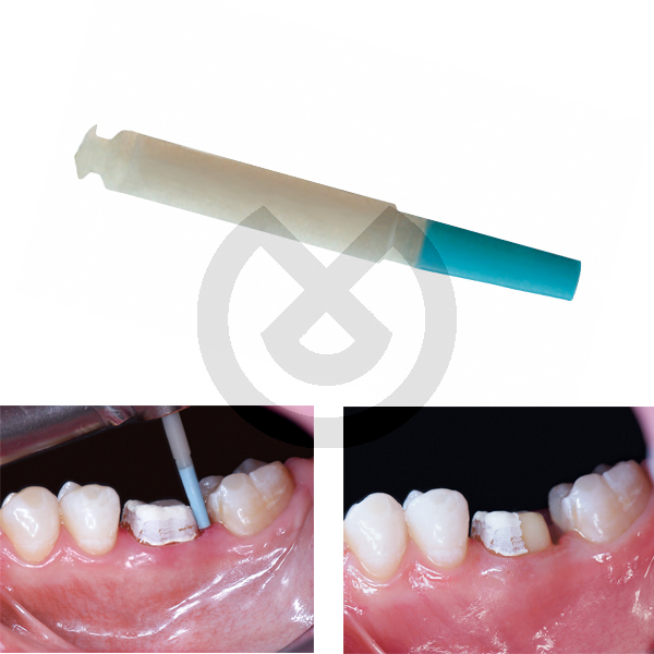 Opticlean 12 st (950) Kerr - KERR