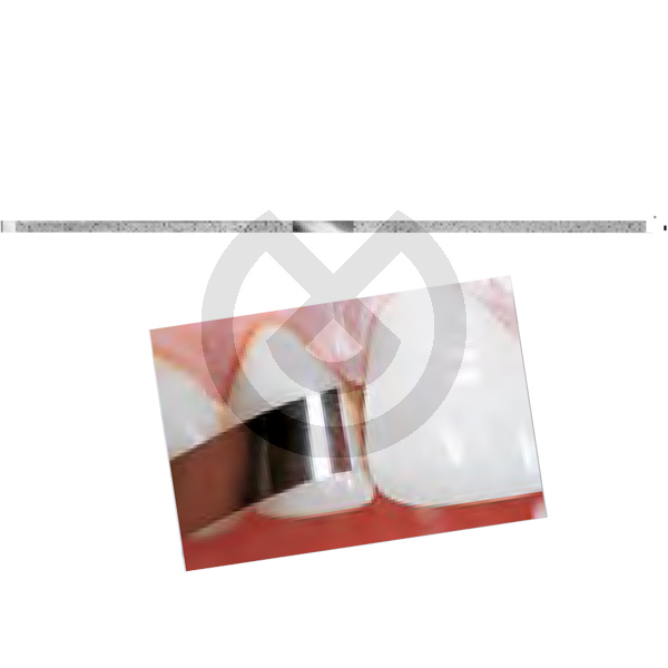 Polerstrips med diamantkorn DS25 – Diamond Polishing Strips Ds25.0.