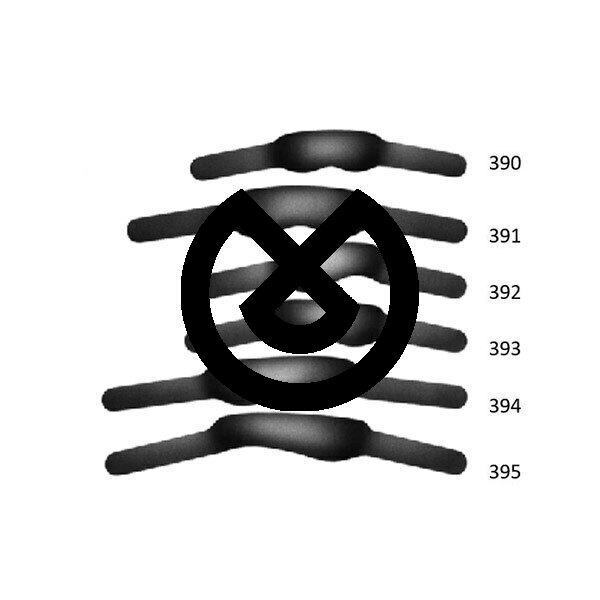Formade matriser – Metal Contoured Matrix 0.045Mm No. 390