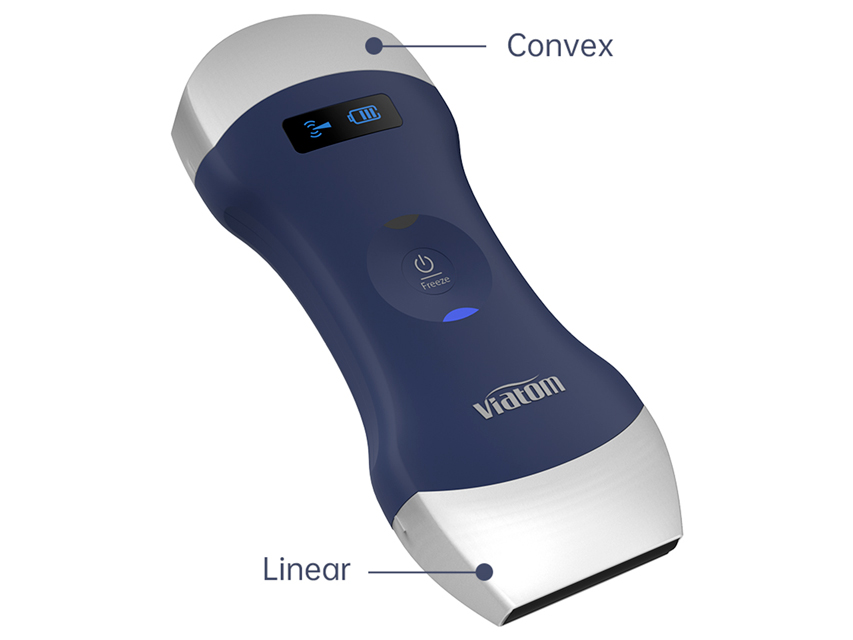 Viatom Dual Head Linear/Convex Trådlös Bärbar Ultraljud